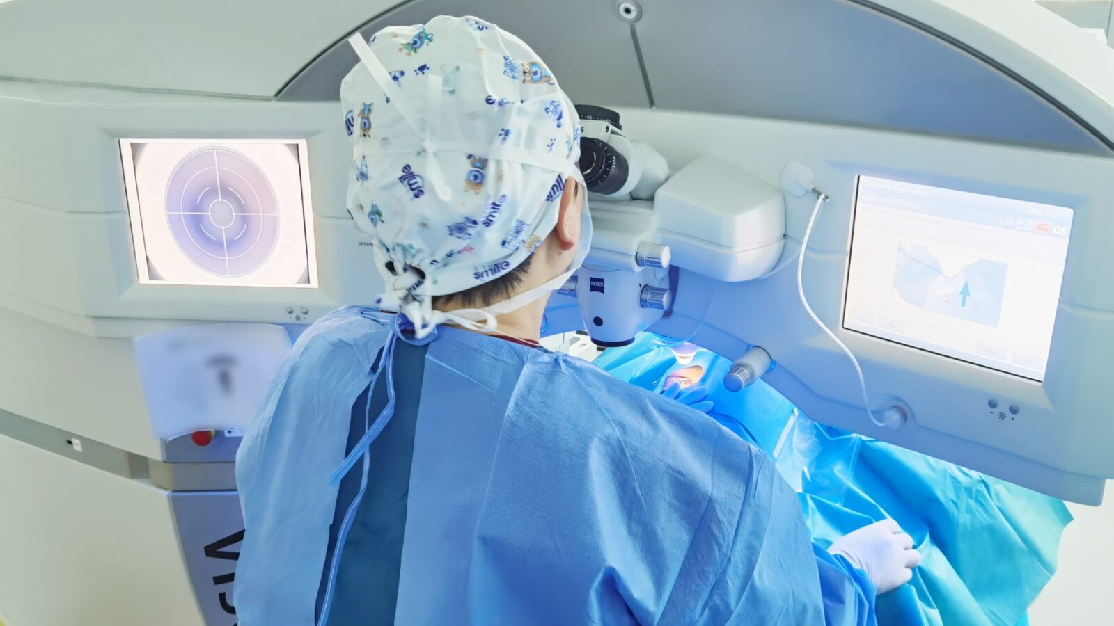 SMILE (Small Incision Lenticule Extraction)