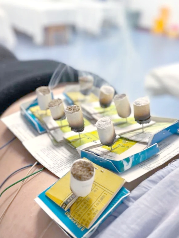 Electro-Warming Needle Acupuncture